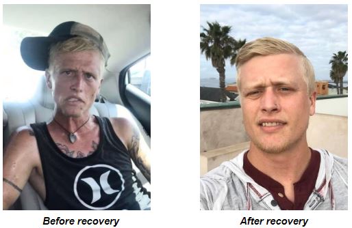 Photo of Cody Bishop in which appears before and after stop consuming heroin