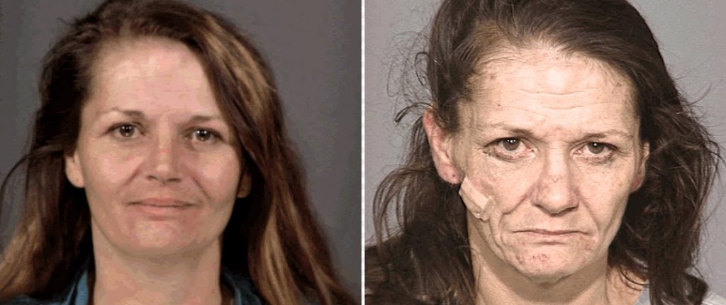 Photo that shows a girl before and after she start to be addict to meth